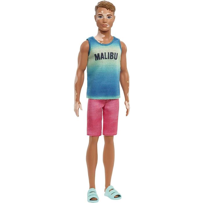 Bambole Barbie Ken Fashionistas con Vitiligine 192